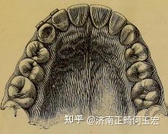 牙齿缝隙大的人面相_牙齿参差不齐 面相_牙齿与面相的关系
