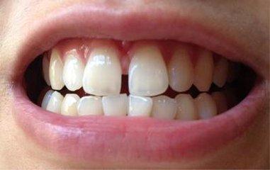 牙齿特别大面相 牙齿算命：牙齿面相学-飞外网