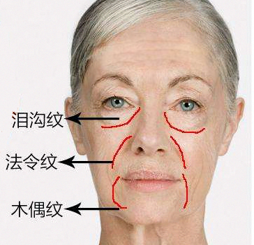 法令纹深的男人面相_男人双法令纹面相图解_好的法令纹面相图解
