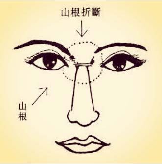 相学白色鼻毛_鼻毛 白色_27岁有白色鼻毛