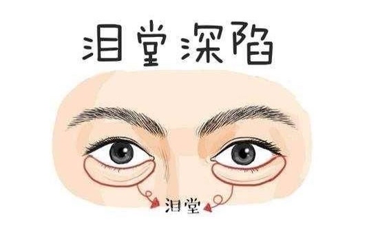 黑眼圈面相大全 身体各脏器的健康状况，可能是你生病了！你家有吗？